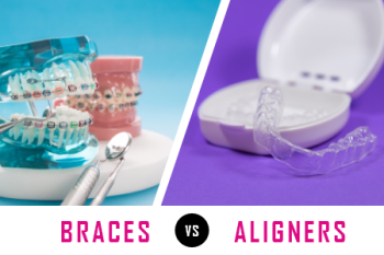 Minneapolis dentist, Dr. Maggie Craven Thompson] of Skyway Dental Clinic talks about what factors need to be considered when deciding between getting braces or clear aligners for corrections. 