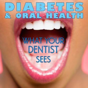 Minneapolis dentist, Dr. Maggie Thompson of Skyway Dental Clinic, discusses the side effects of diabetes and how it affects your oral health.