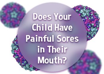 Minneapolis dentist, Dr. Maggie Craven Thompson at Skyway Dental Clinic tells parents about a common viral infection that may present with sores in your child’s mouth.