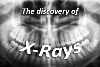Minneapolis dentist, Dr. Maggie Thompson at Skyway Dental Clinic discusses the discovery of x-rays and how they have advanced over the years.